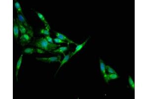 Immunofluorescence staining of Hela cells with ABIN7157178 at 1:100, counter-stained with DAPI. (Junctophilin 1 anticorps  (AA 431-546))