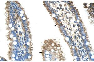 Human Intestine (ALDH4A1 anticorps  (N-Term))