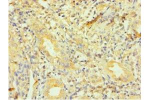 Immunohistochemistry of paraffin-embedded human kidney tissue using ABIN7150804 at dilution of 1:100