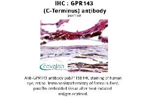 Image no. 1 for anti-G Protein-Coupled Receptor 143 (GPR143) (C-Term) antibody (ABIN1734946) (GPR143 anticorps  (C-Term))