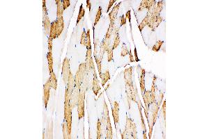 Anti-Myoglobin antibody, IHC(P) IHC(P): Rat Skeletal Muscle Tissue
