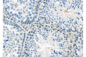 ABIN6263540 and ABIN6279810 at 1/100 staining Mouse testis tissue by IHC-P.
