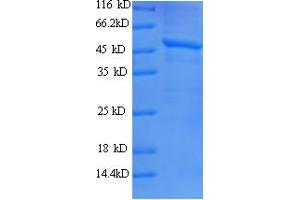 SDS-PAGE (SDS) image for Janus Kinase 2 (JAK2) (AA 752-1132), (partial) protein (His tag) (ABIN5709779)