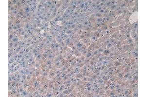 IHC-P analysis of Mouse Liver Tissue, with DAB staining. (IL-2 anticorps  (AA 10-169))