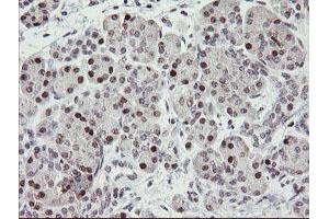 Image no. 3 for anti-Replication Factor C (Activator 1) 2, 40kDa (RFC2) (AA 1-234) antibody (ABIN1490616)