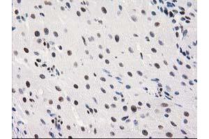 Immunohistochemical staining of paraffin-embedded Human Ovary tissue using anti-MEF2C mouse monoclonal antibody. (MEF2C anticorps)