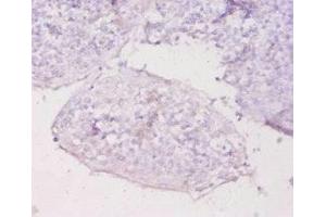 Immunohistochemistry of paraffin-embedded human tonsil tissue using ABIN7159517 at dilution of 1:20 (MT1E anticorps  (AA 4-59))