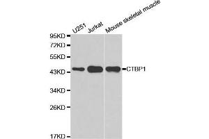 Western blot analysis of extracts of various cell lines, using CTBP1 antibody. (CTBP1 anticorps  (AA 20-250))