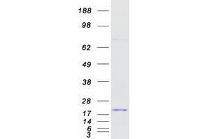 Validation with Western Blot
