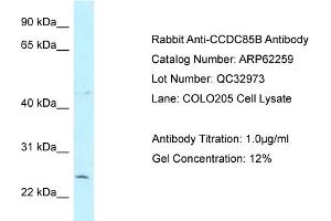 Western Blotting (WB) image for anti-Coiled-Coil Domain Containing 85B (CCDC85B) (N-Term) antibody (ABIN2789085) (CCDC85B anticorps  (N-Term))