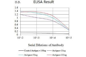 Black line: Control Antigen (100 ng),Purple line: Antigen (10 ng), Blue line: Antigen (50 ng), Red line:Antigen (100 ng)