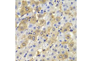 Immunohistochemistry of paraffin-embedded human liver injury using DSP antibody (ABIN5975859) at dilution of 1/100 (40x lens). (Desmoplakin anticorps)