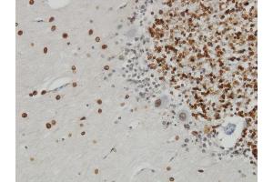 Immunoperoxidase of monoclonal antibody to TPR on formalin-fixed paraffin-embedded human cerebellum.