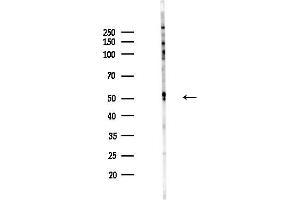 Western blot analysis of lysates from HepG2 cells(starvation,24h treatment), using FOX Antibody at 1/1000 dilution.