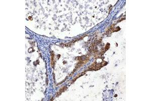 IHC analysis of SUMF2 using anti-SUMF2 antibody (ABIN7600954).