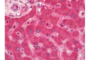 Human Liver: Formalin-Fixed, Paraffin-Embedded (FFPE).