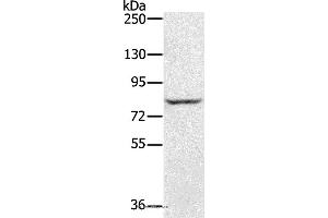 Western blot analysis of Jurkat cell, using RNF43 Polyclonal Antibody at dilution of 1:300 (RNF43 anticorps)