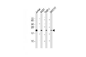 Lane 1: Jurkat Cell lysates, Lane 2: A431 Cell lysates, Lane 3: THP-1 Cell lysates, Lane 4: 293T/17 Cell lysates, probed with BID (1519CT649.