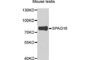 Western blot analysis of extracts of mouse testis, using SPAG16 antibody. (SPAG16 anticorps)