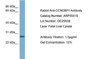 WB Suggested Anti-CCNDBP1  Antibody Titration: 0. (CCNDBP1 anticorps  (Middle Region))