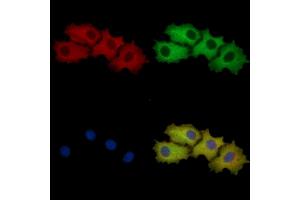 YTHDF1 Mouse Monoclonal Antibody staining HepG2 cells by IF/ICC. (YTHDF1 anticorps  (N-Term))