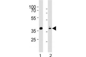 Western blot analysis of lysate from mouse stomach, rat heart tissue (left to right) using Mouse Nkx2. (NK2 Homeobox 5 anticorps  (AA 192-225))