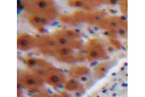 Used in DAB staining on fromalin fixed paraffin-embedded Liver tissue (AGT anticorps  (AA 23-477))