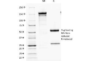 SDS-PAGE Analysis Purified PTH Mouse Monoclonal Antibody (PTH/1173). (PTH anticorps  (AA 32-115))