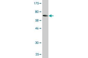 Western Blot detection against Immunogen (72.