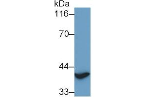 Detection of TITF1 in Rat Heart lysate using Polyclonal Antibody to Thyroid Transcription Factor 1 (TITF1) (NKX2-1 anticorps)
