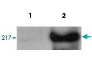 HeLa cells were transfected with CHD5 and analysed by Western blot. (CHD5 anticorps)