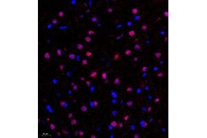 Immunofluorescence of paraffin embedded rat hippocampus using FGF11 (ABIN7073941) at dilution of 1:2200 (400x lens)