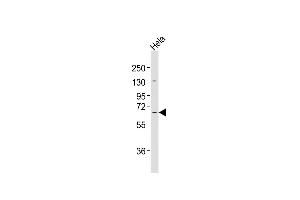 Anti-MLLT1 Antibody at 1:2000 dilution + Hela whole cell lysates Lysates/proteins at 20 μg per lane. (MLLT1 anticorps  (C-Term))