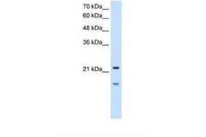 Image no. 1 for anti-Matrix Metallopeptidase 7 (Matrilysin, Uterine) (MMP7) (C-Term) antibody (ABIN321032) (MMP7 anticorps  (C-Term))