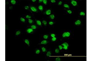 Immunofluorescence of monoclonal antibody to SIX4 on HeLa cell. (SIX4 anticorps  (AA 672-780))