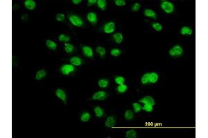 Immunofluorescence of monoclonal antibody to SIX4 on HeLa cell.