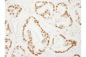 anti-Activated RNA Polymerase II Transcriptional Coactivator p15 (SUB1) (AA 77-127) antibody