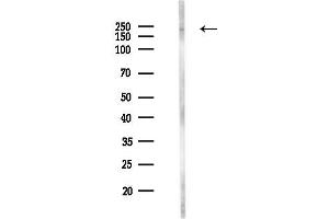 anti-Chromodomain Helicase DNA Binding Protein 4 (CHD4) (Internal Region) antibody