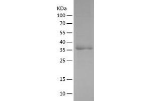 Western Blotting (WB) image for Growth Differentiation Factor 9 (GDF9) (AA 320-454) protein (His-IF2DI Tag) (ABIN7123215)