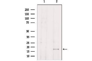 Western blot analysis of extracts from HepG2, using TP53I11 Antibody. (TP53I11 anticorps  (N-Term))