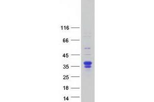 Validation with Western Blot