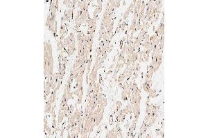Immunohistochemical analysis of paraffin-embedded human heart tissue using (ABIN1538329 and ABIN2849397) performed on the Leica® BOND RXm. (CALCRL anticorps  (AA 340-367))