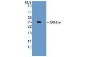 Figure. (Transgelin anticorps  (AA 1-201))