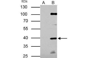 IP Image E2F1 antibody [N1N3] immunoprecipitates E2F1 protein in IP experiments. (E2F1 anticorps)