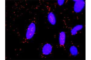 Proximity Ligation Analysis of protein-protein interactions between SMURF1 and GNG11.