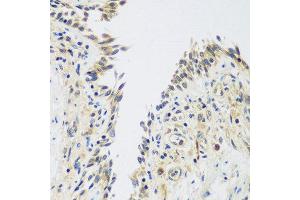 Immunohistochemistry of paraffin-embedded human lung using UPF2 antibody at dilution of 1:100 (40x lens). (RENT2/UPF2 anticorps)