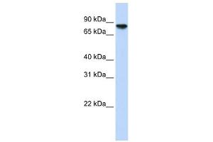 Glycogen Synthase 2 antibody used at 1 ug/ml to detect target protein. (Glycogen Synthase 2 anticorps)