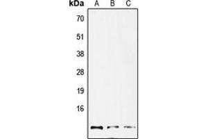 Western blot analysis of GNG12 expression in HepG2 (A), mouse lung (B), rat lung (C) whole cell lysates. (GNG12 anticorps  (Center))