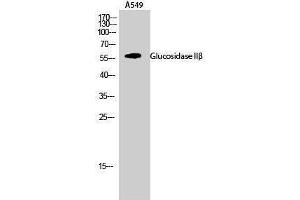 Western Blotting (WB) image for anti-Glucosidase, beta (Bile Acid) 2 (GBA2) (Internal Region) antibody (ABIN3175282) (GBA2 anticorps  (Internal Region))