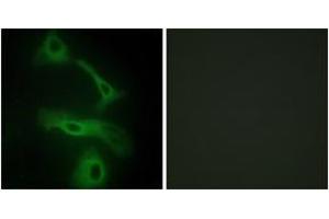 Immunofluorescence analysis of HeLa cells, using CLUS Antibody. (Clusterin anticorps  (AA 400-449))